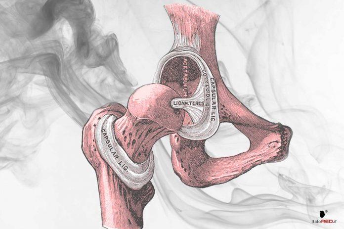 Gli-impianti-ossei italo red italo